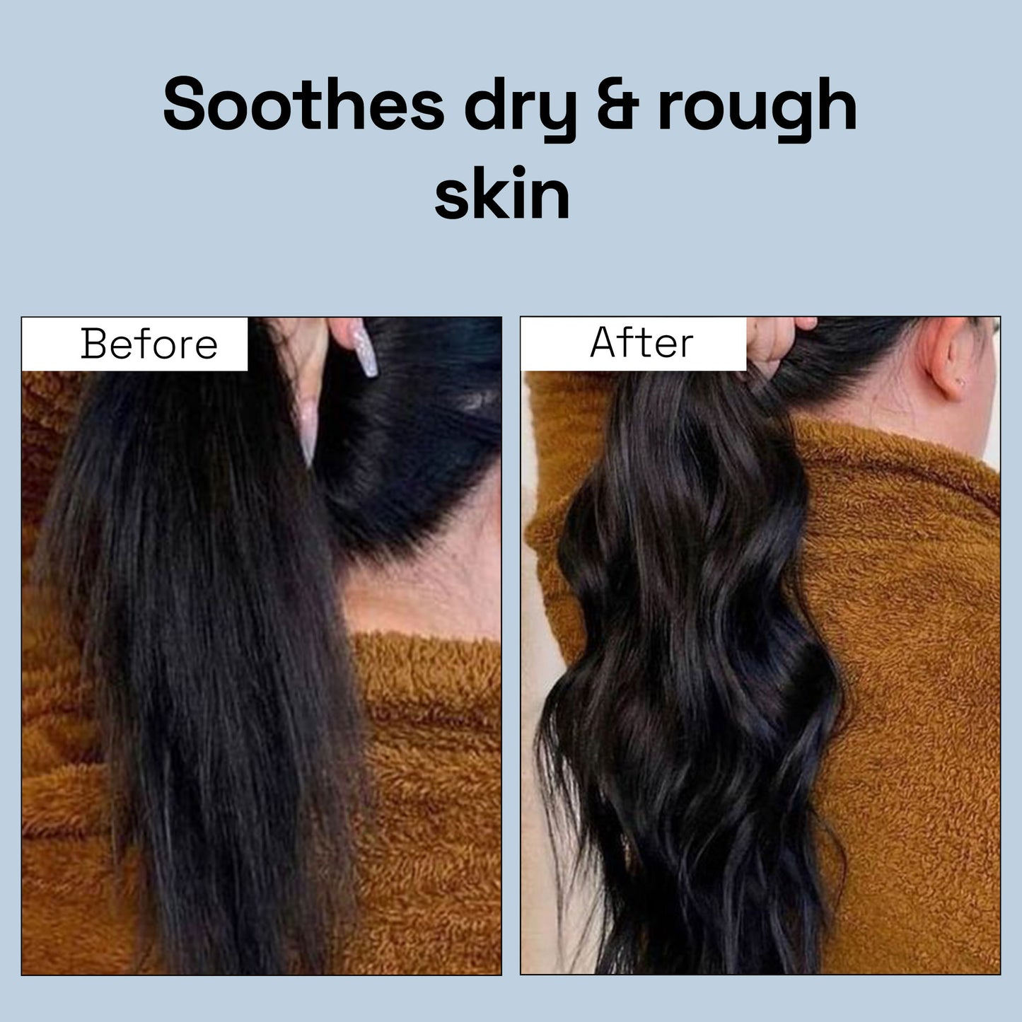 Soulflower Tea Tree Hair Oil For Scalp & Dandruff