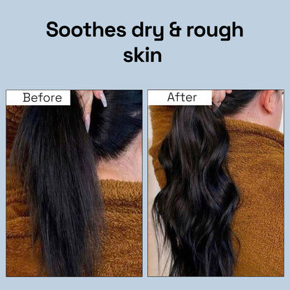 Soulflower Tea Tree Hair Oil For Scalp & Dandruff